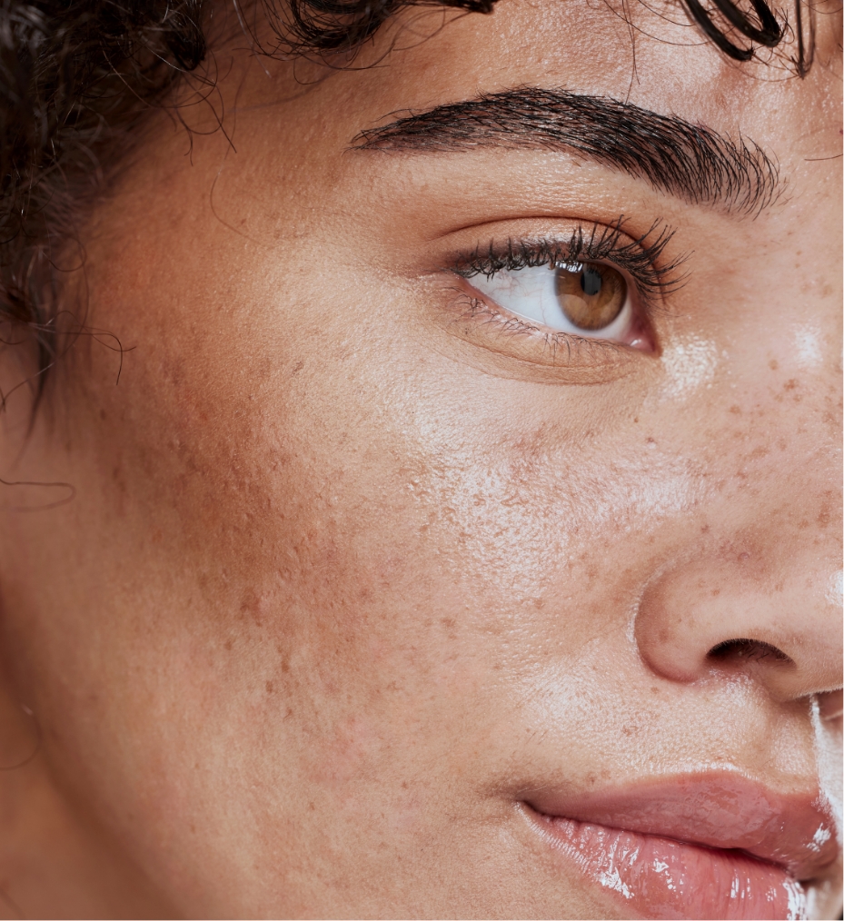 Southern Face and Body lady facing the camera close up of her face with smooth skin