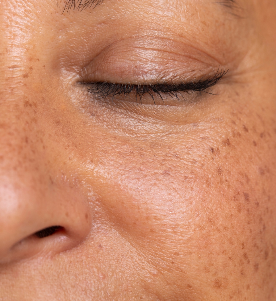 Southern Face and Body lady facing the camera close up of her face with smooth skin